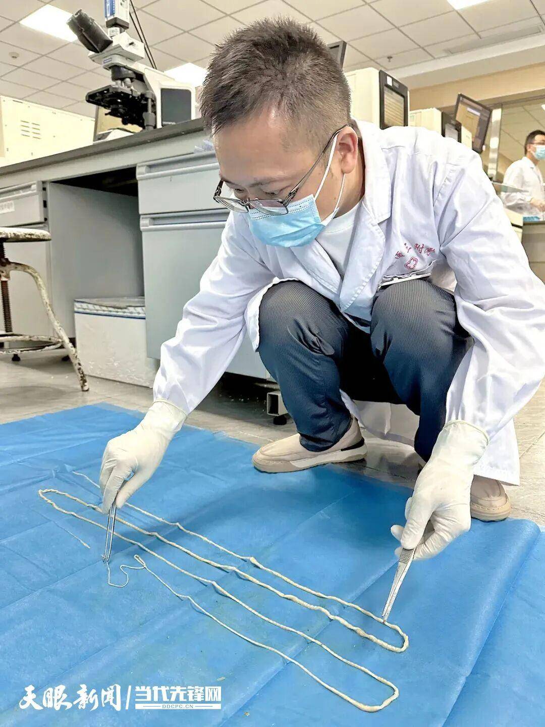 山口雷法 vs 千叶市原_最长4米!贵州一男子连续7个月排出“面条状异物”山口雷法 vs 千叶市原,医生:很可能和吃这种生食有关